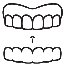 Invisalign®. Invisalign in Lincoln, NE a great alternative to traditional braces unless traditional braces are the best option.
